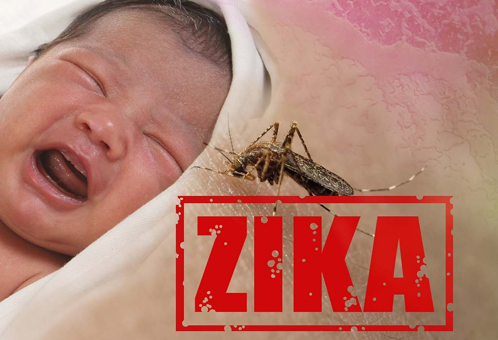 Infection au virus Zika chez les enfants 3 infection par le virus Zika chez les enfants