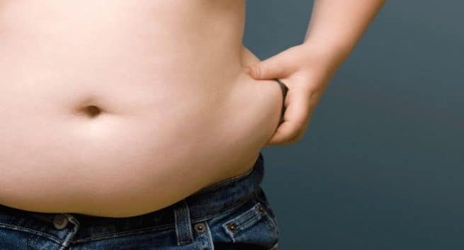 Obesity