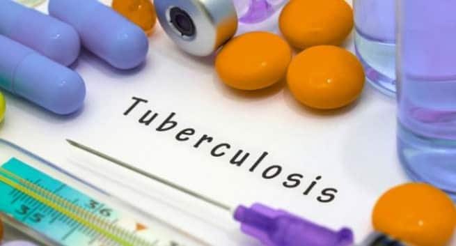 Deux nouveaux vaccins se sont révélés prometteurs dans la prévention de la tuberculose, le principal tueur de maladies infectieuses au monde 1 Tuberculosis and DOTS Hindi