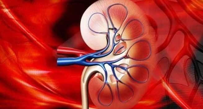 kidney-disease