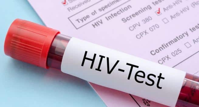 HIV-test