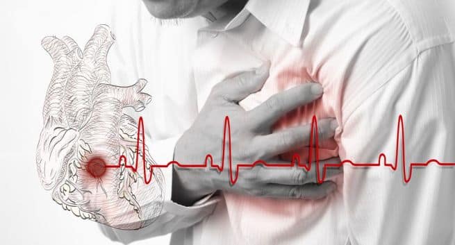 Cardiac-problems