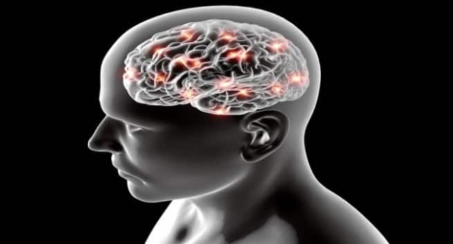 brain stroke
