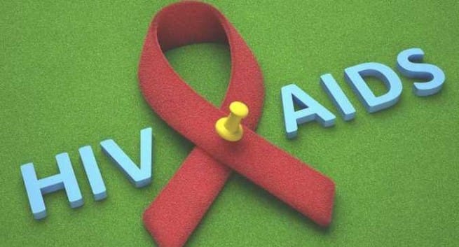 HIV-AIDS