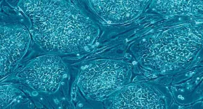 T cells