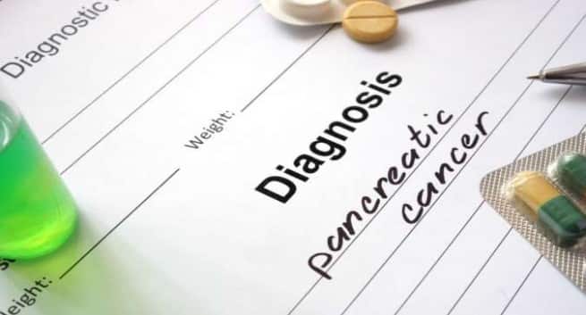 Survie au cancer du pancréas liée à quatre gènes 5 diagnosis of pancreatic cancer