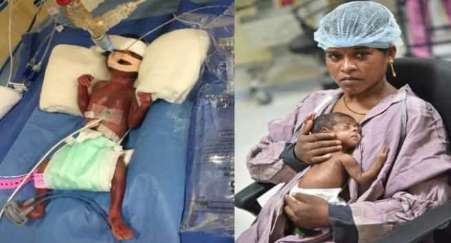 Une petite fille gravement prématurée subit une chirurgie cardiaque pédiatrique rare; vie sauvée par l'hôpital Artemis 1 Une petite fille gravement prématurée subit une chirurgie cardiaque pédiatrique rare; vie sauvée par l'hôpital Artemis