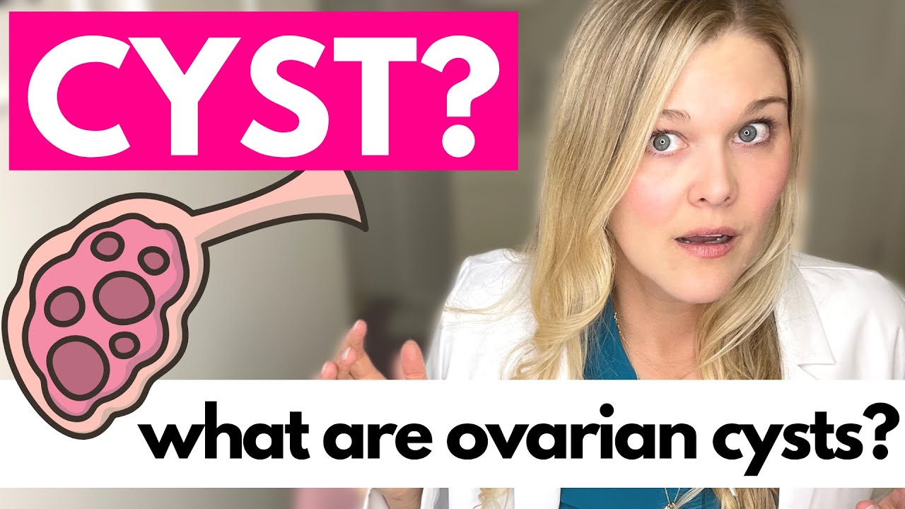 Cysta på äggstock 5 tecken på att du bör söka vård 11 cysta på äggstock