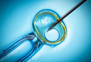 In-vitro-Fertilisation 