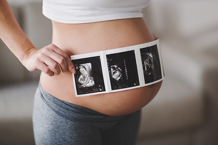 8 schreckliche Dinge, die Ihr Baby während eines Ultraschalls tut, die völlig normal sind