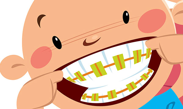 DIY Zahnspangen Trend gefährdet Kinder