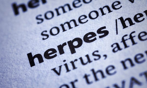 Studie findet Herpes-Autismus-Verbindung