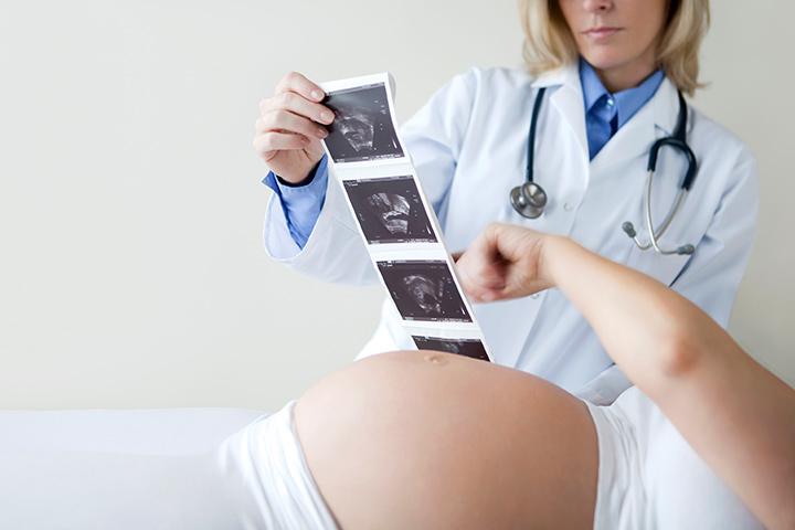 In diesem Fall kann Ihr Arzt das Geschlecht Ihres Babys vorhersagen