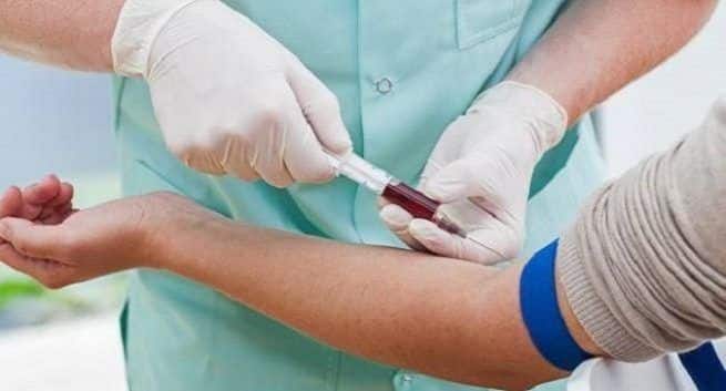 COVID-19-Test: Dieser Bluttest kann Coronavirus in nur 20 Minuten nachweisen