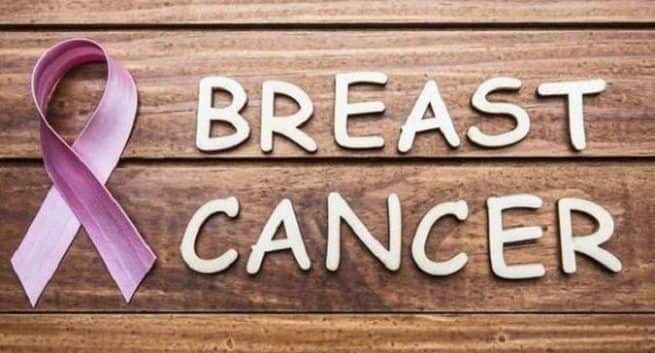 breast-cancer risk factors