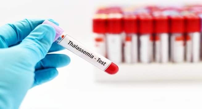 Thalassemia in hindi