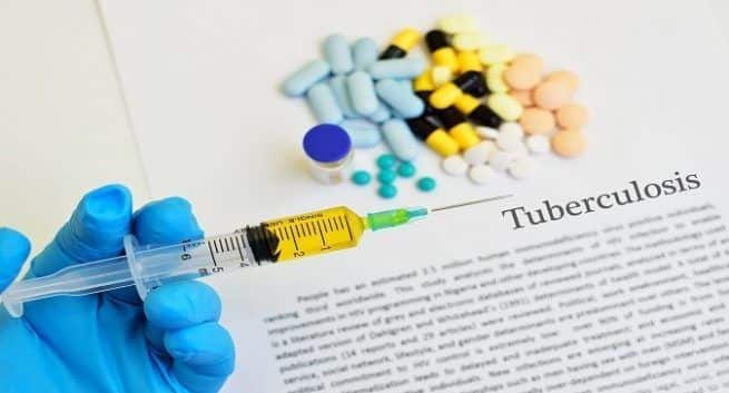 Indien verzeichnet bis 2017 eine 84% ige Verringerung der TB-Todesfälle bei Menschen mit HIV