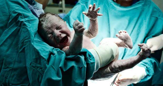Premature births