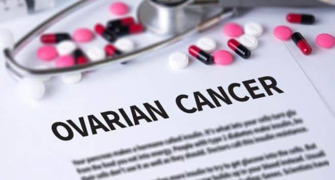 When to go for ovarian cancer screening