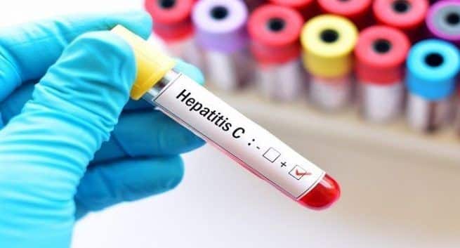 Hepatitis-C