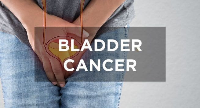This drug can reduce death risk in patients with common bladder cancer