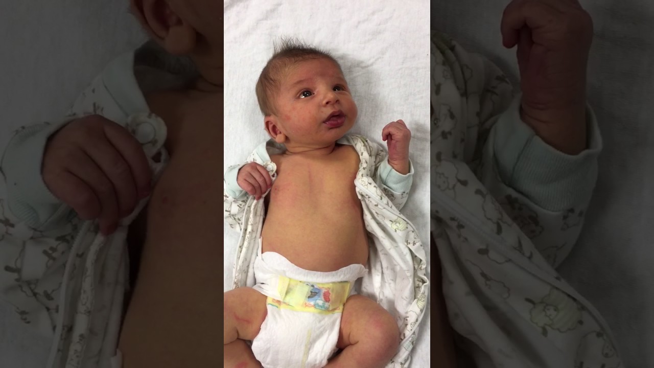 Pylorusstenose baby erfahrung: 5 Erkenntnisse für Eltern 1 pylorusstenose baby erfahrung