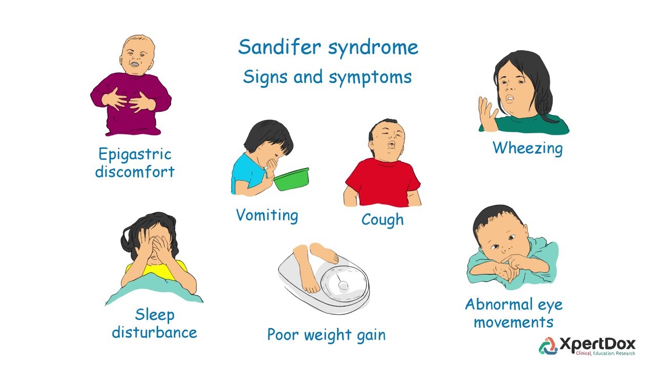 sandifer syndrome