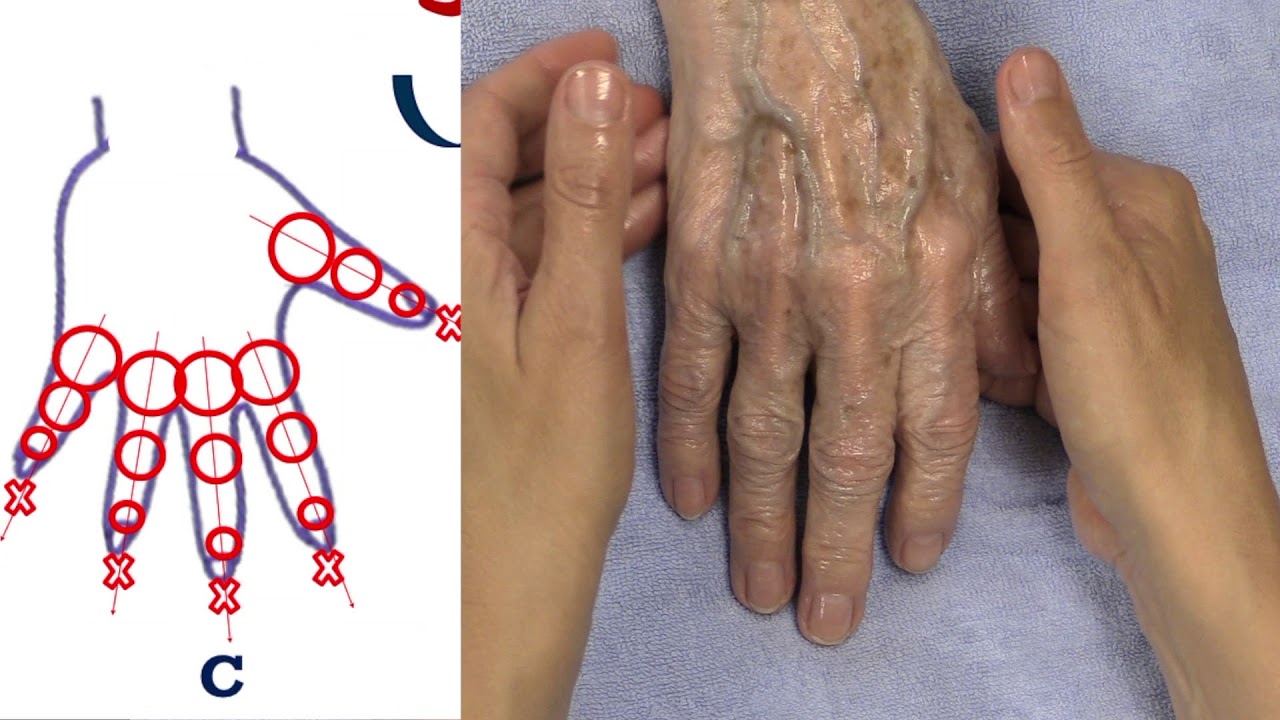 therapeutische handmassage