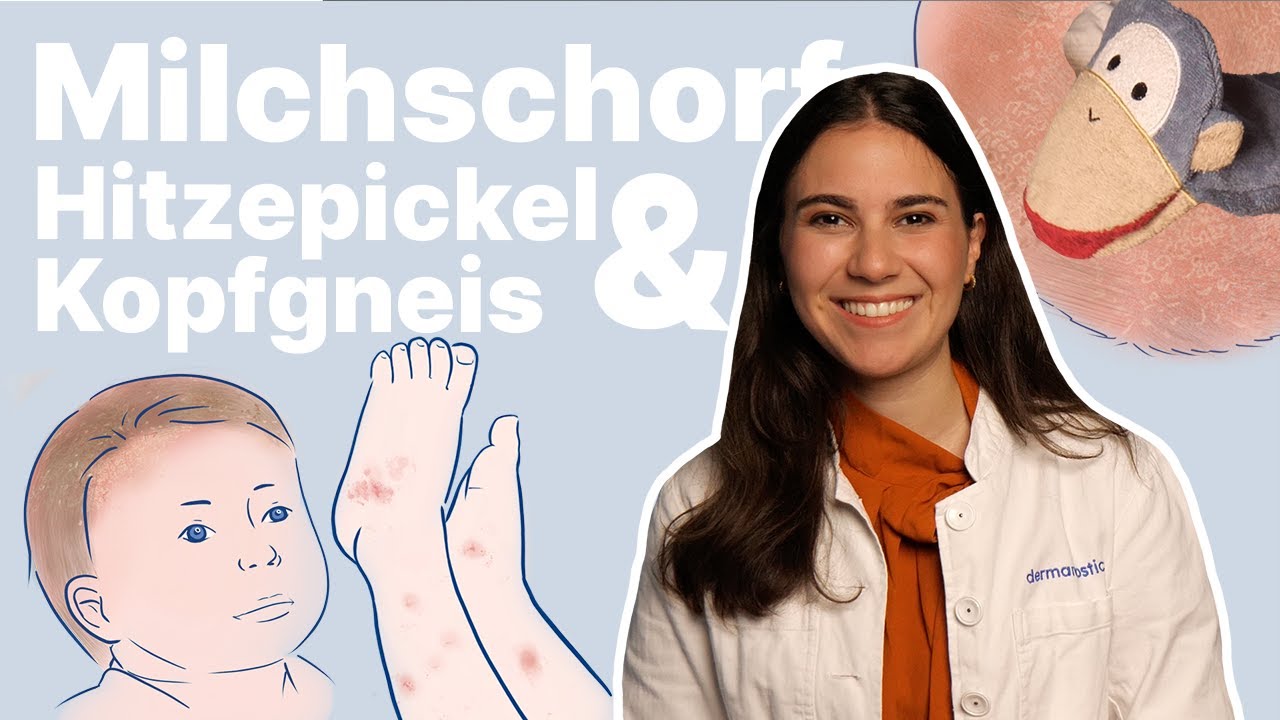 Baby Gesichtsausschlag Arten Ursachen und Behandlung: 7 wichtige Infos 2025 5 baby gesichtsausschlag arten ursachen und behandlung