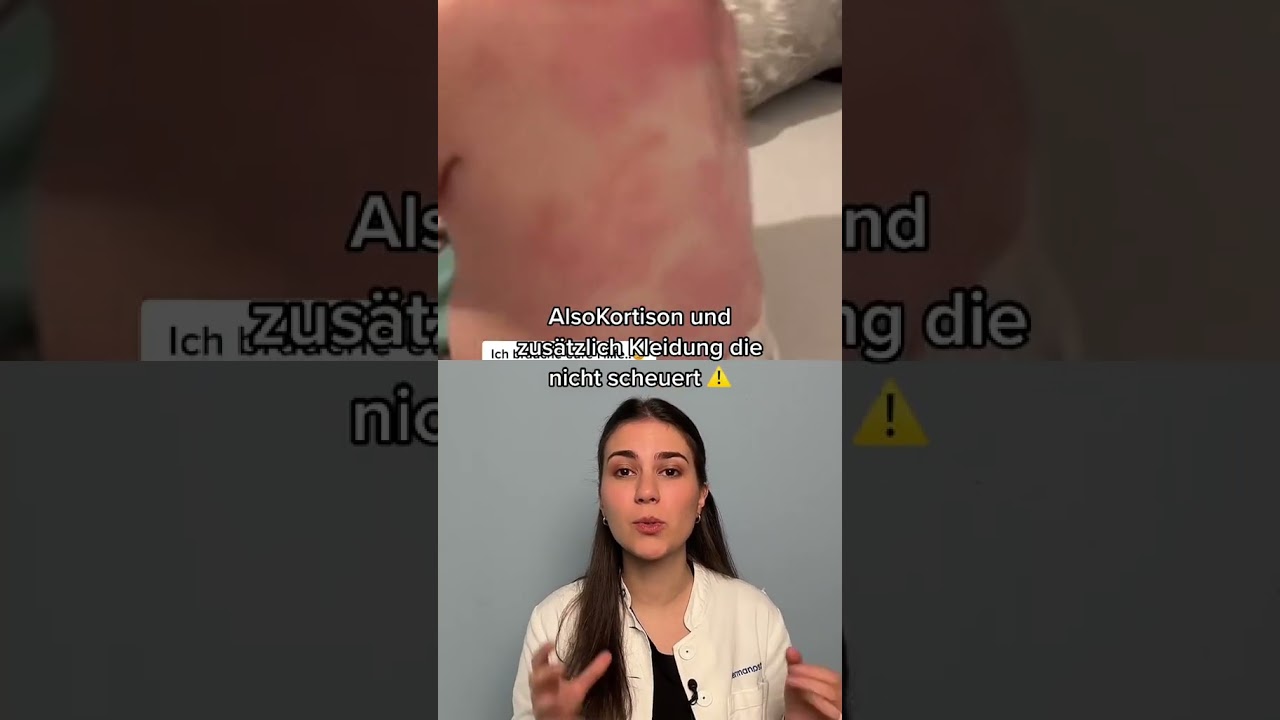 hautausschlag im gesicht des babys arten ursachen und behandlung