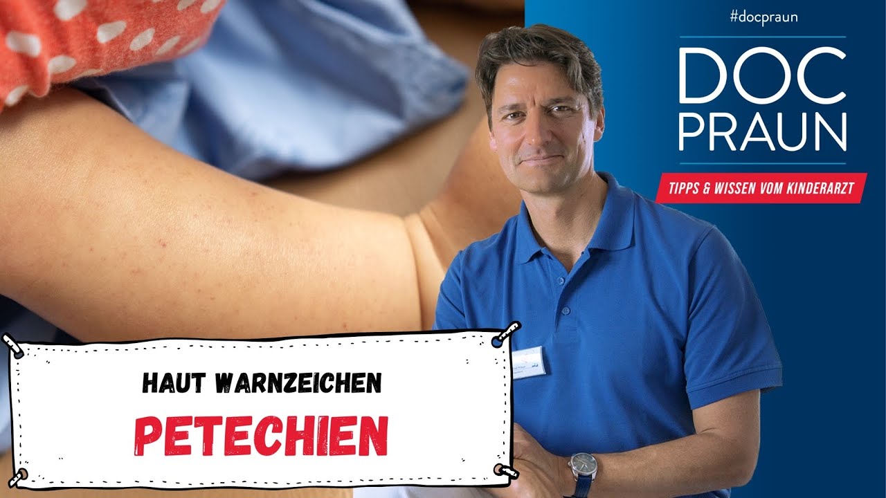 petechien bei babys ursachen diagnose und behandlungen die sie kennen sollten